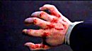 Angel's bloody knuckles